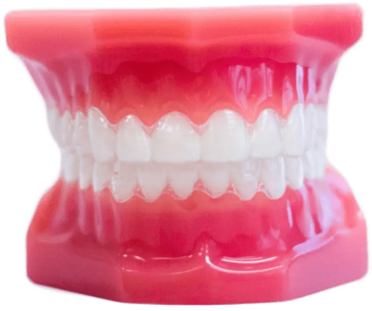 Windy City Orthodontics aligners